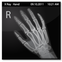 X-Ray_Hand icon